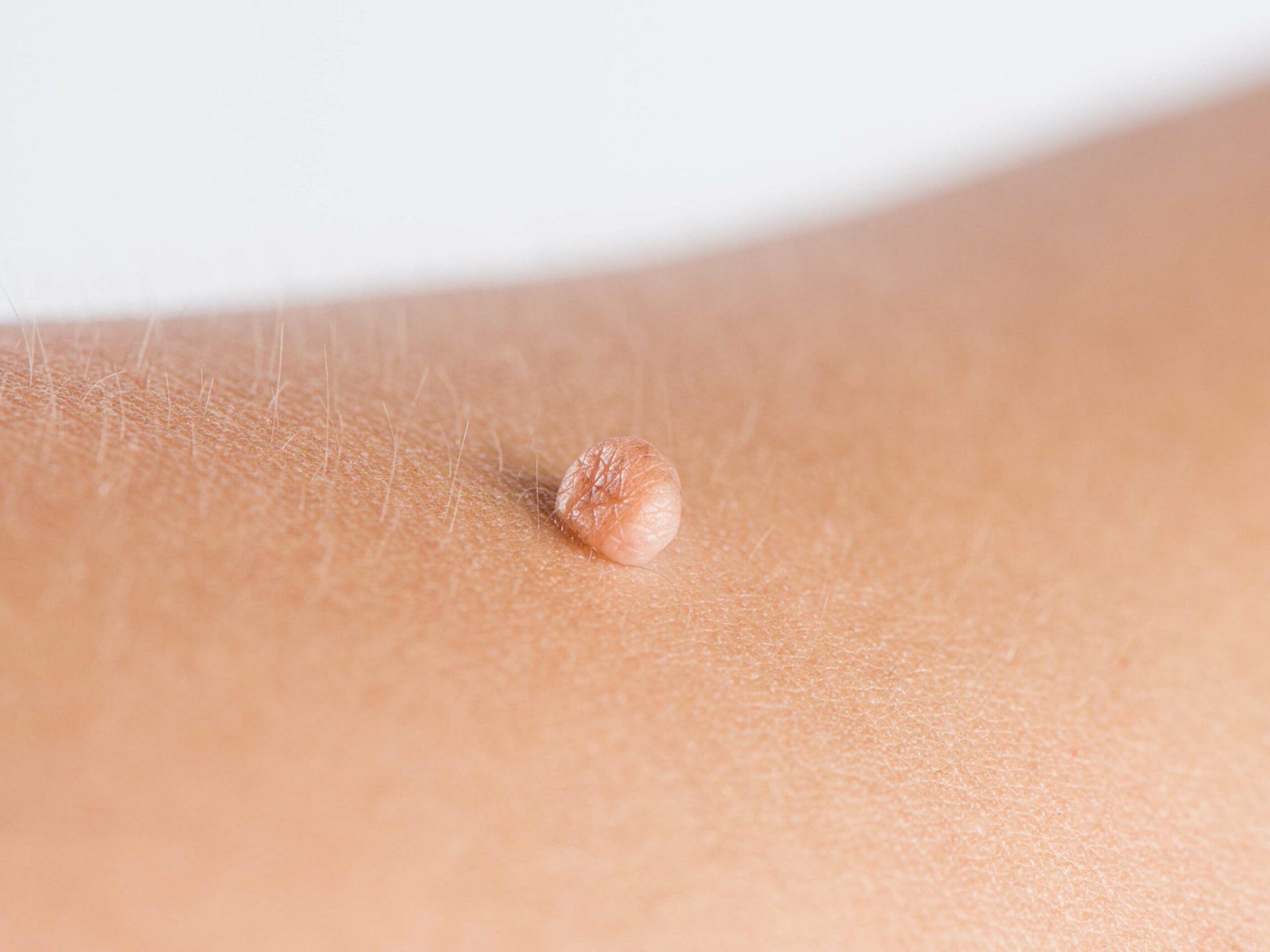 AdobeStock_527717841-min-scaled-slider-min